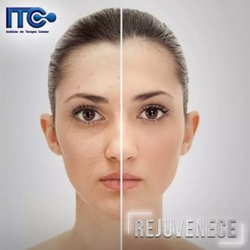 Slider image (2) Instituto de Terapia Celular - Stem Cell Guadalajara Mexico